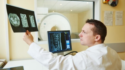 Médico analisando a impressão radiológica