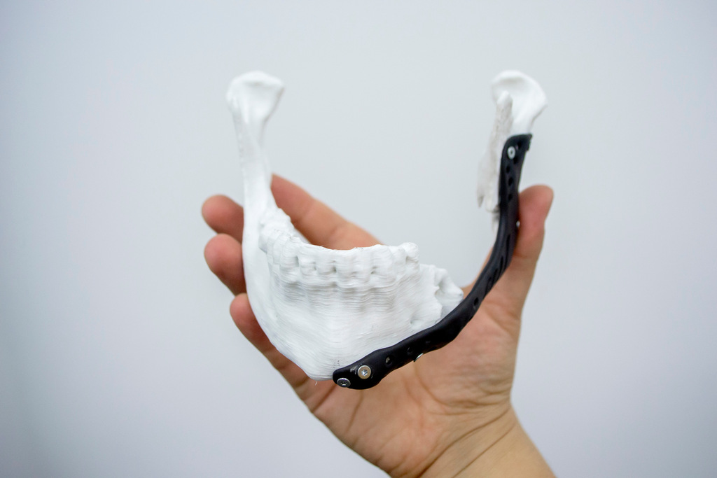 Impressão 3D na medicina: entenda as vantagens e desvantagens
